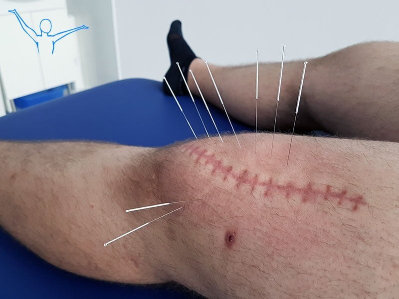 Rehabilitacja z dojazdem do pacjenta Warszawa